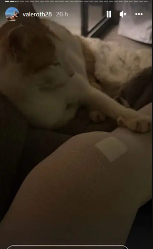 val2 La influencer Valentina Roth compartió con sus seguidores detalles de de la operación de urgencia que se realizó este pasado viernes 8 de abril tras una dura lesión en su rodilla.