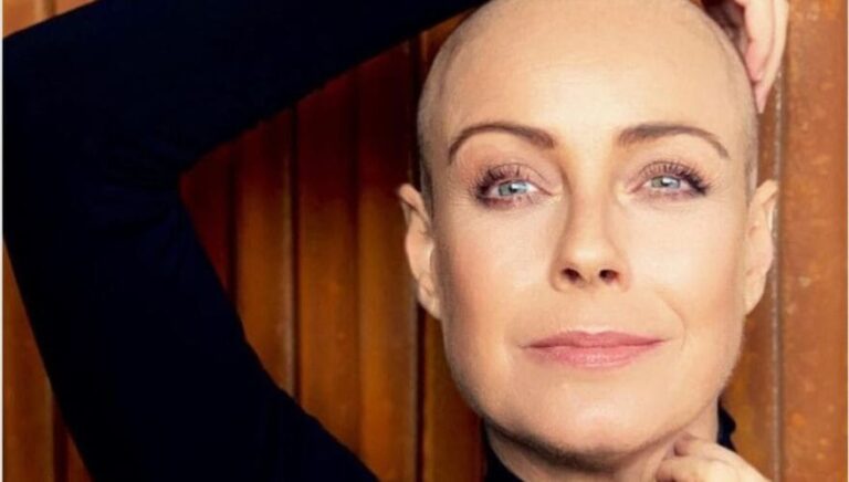 Está con varias quimios en el cuerpo: Fran Conversa actualizó el estado de salud de Claudia tras compartir importante cambio físico