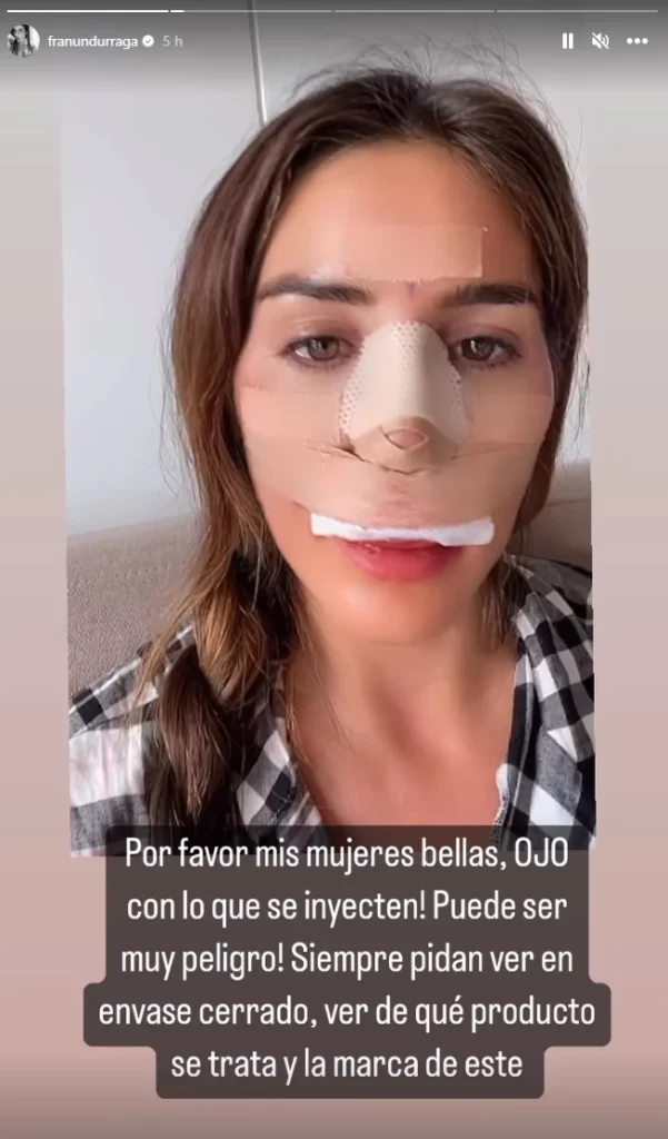 francisca La influencer preocupó a sus seguidores tras revelarse las complicaciones de su retoque estético