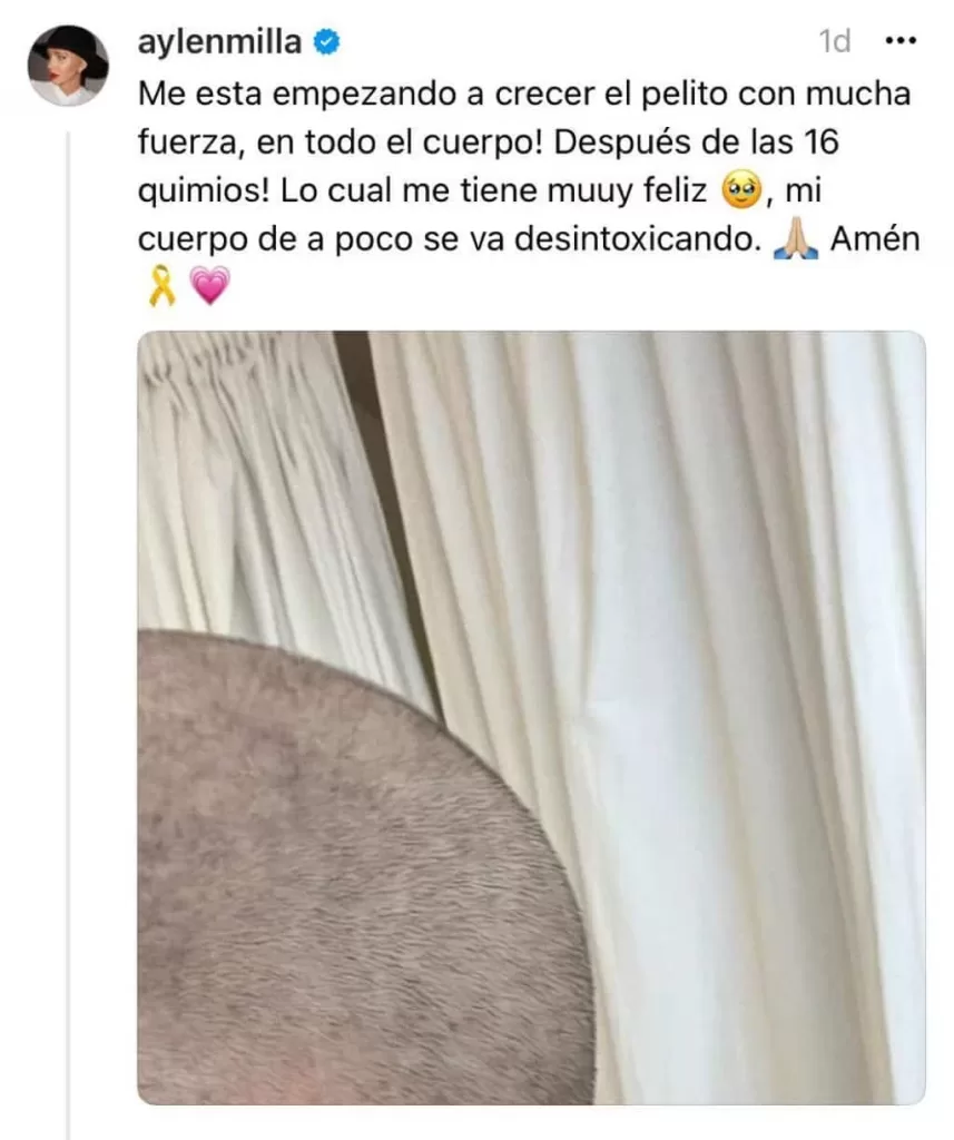 aylen "Me está empezando a crecer el pelito" confesó la influencer argentina en sus redes sociales.