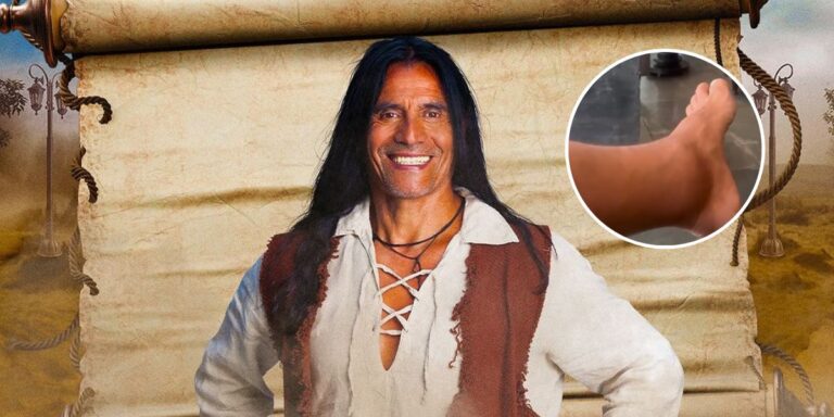 “Me hicieron competir lesionado” Coca Mendoza muestra como quedo su tobillo tras dolorosa lesión 2 Coca Mendoza lesionado / Ganar o Servir