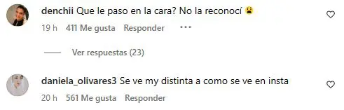¿Pero qué te paso en la cara? Nueva apariencia de Coté López genera preocupación entre sus seguidores 2 coote1 Estas intervenciones cambiaron notablemente los rasgos que la hicieron famosa en Chile desde una edad temprana.