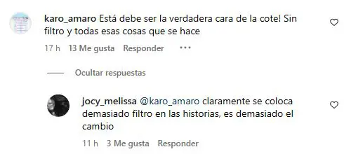 ¿Pero qué te paso en la cara? Nueva apariencia de Coté López genera preocupación entre sus seguidores 4 coote3 Estas intervenciones cambiaron notablemente los rasgos que la hicieron famosa en Chile desde una edad temprana.