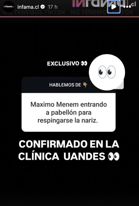 Filtran que Máximo Bolocco se sometió a cirugía y está internado en la clínica en por este motivo 2 cirugia maximo 467x690 1 Este jueves 1 de mayo, una sorpresiva información encendió las redes: Máximo Bolocco, hijo de Cecilia Bolocco y Carlos Menem, habría ingresado a la Clínica Universidad de Los Andes para realizarse una cirugía estética.