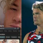 «Sigue hospitalizado» El grave daño muscular que afecta a Raimundo Cerda  tras final de Palabra de Honor y que puede envenenar sus órganos