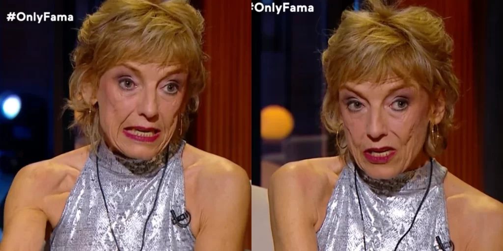 La dura secuela que marcó a Adriana Vacarezza: el problema mandibular que complica su día a día 4 adriana onlyfama Adriana Vacarezza fue parte del último capítulo de Only Fama, donde abordó en profundidad el accidente que la alejó de la televisión y cómo ha debido convivir con las secuelas físicas y emocionales que marcaron su vida.