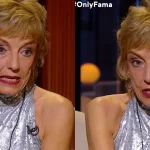 La dura secuela que marcó a Adriana Vacarezza: el problema mandibular que complica su día a día 3 La dura secuela que marcó a Adriana Vacarezza: el problema mandibular que complica su día a día