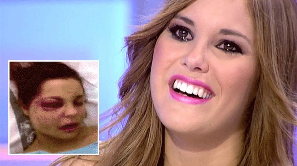 “¿No le da vergüenza?”: Gissella Gallardo en el centro de las críticas por burlesca reacción al ver fotos de Gala Caldirola antes del accidente 2 gala antes del accidente Una comentada y polémica situación se vivió este martes en el programa Hay que decirlo, donde una reacción en pantalla no pasó desapercibida para los televidentes y rápidamente se trasladó a las redes sociales.