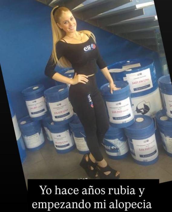 Ignacia Michelson sorprende al mostrar antigua foto con un look irreconocible y hablar sin filtro sobre su alopecia 2 michelson rubia.JPG La influencer recordó sus inicios, visibilizó su problema capilar y reafirmó su mensaje de aceptación personal, asegurando que la actitud pesa más que cualquier cambio físico.