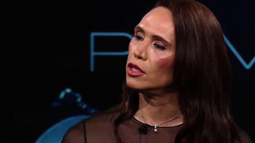 635788115 1477027150457703 5599851725479005663 n Durante la noche del domingo, Di Mondo sorprendió al entregar una de las confesiones más íntimas de su vida en el programa Primer Plano, donde abordó la condición médica que enfrenta desde hace un tiempo.