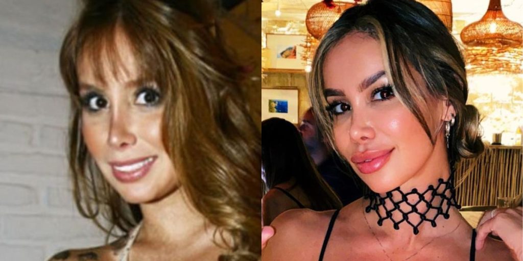Miniatura web 3 La exmodelo argentina dejó atrás una fallida operación realizada en 2008 y sorprendió en redes sociales al mostrar el resultado de una nueva intervención que cambió por completo su apariencia.
