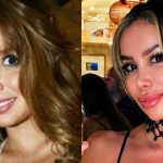 Romina Zalazar reaparece con renovada imagen tras compleja cirugía nasal: luce irreconocible