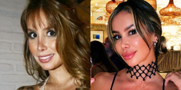 Romina Zalazar reaparece con renovada imagen tras compleja cirugía nasal: luce irreconocible