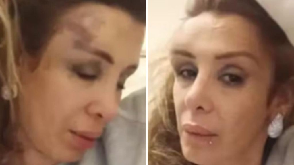 Romina Saez golpiza instagram Romina Sáez relató que fue atacada durante una salida nocturna en Santiago y acusó una total falta de respuesta del local tras el grave incidente.