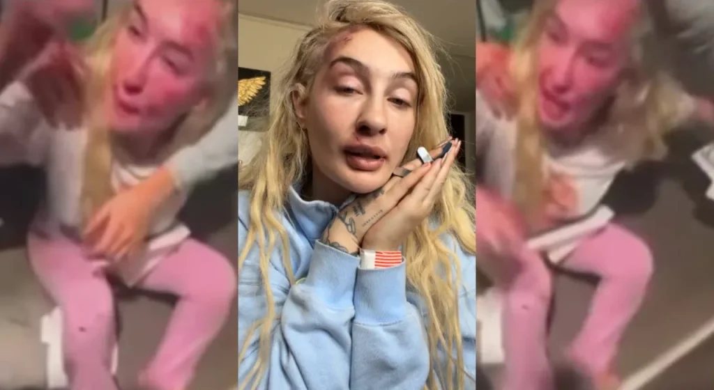 Difunden video de Fran Maira tras violento episodio: registro abrió nuevas dudas sobre lo ocurrido