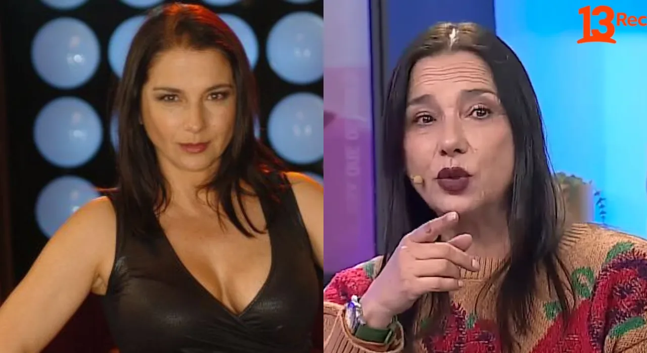 “Me merezco la cara que tengo”: Katty Kowaleczko reveló por qué dejó los retoques estéticos