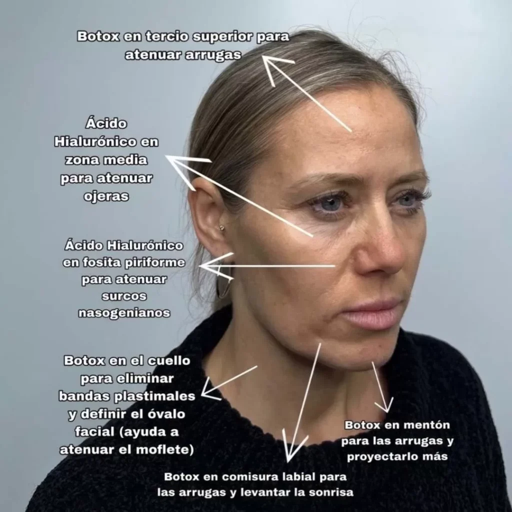 Ludmila Ksenofontova sorprendió al mostrar renovado rostro tras retoques estéticos: así quedó 2 Ludmila Ksenofontova sorprendió al mostrar renovado rostro tras retoques estéticos: así quedó