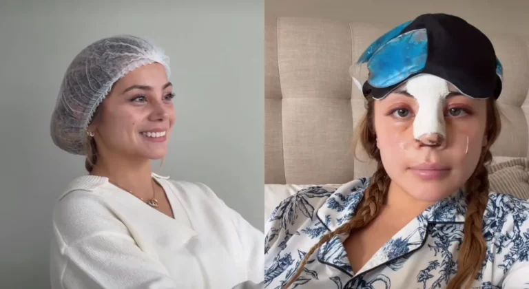 “No opine de cuerpos ajenos”: Skarleth Labra frenó las críticas tras mostrar su cirugía de nariz