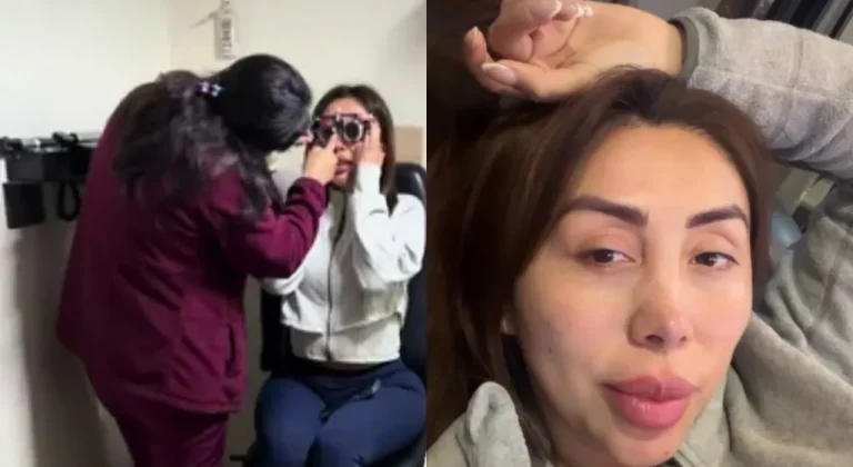 “Me empezaron a arder”: Naya Fácil mostró cómo quedaron sus ojos tras probar lentes de contacto